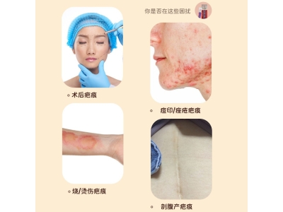 北京同仁堂内廷上用护理软膏疤痕凝胶20g工厂直营代理一件代发图3